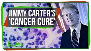 Jimmy Carters Cancer Cure [upl. by Alorac268]