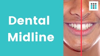 DENTAL MIDLINE SHIFT What why and how to correct l Dr Melissa Bailey [upl. by Drew837]