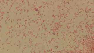 Moraganella morganii in Gram Staining [upl. by Ecad]