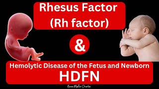 Rhesus Disease and HDFN [upl. by Nosidda]