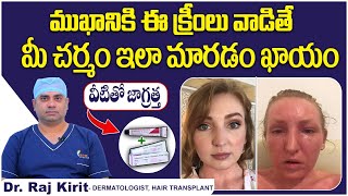 ఆ క్రీంలు వాడడం వల్ల  Skin Lite Cream Side Effects On Face  Steroid Cream  Celestee Clinic [upl. by Bajaj]