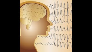 Rapid summary of Epilepsy with pregnancy amp Obstetric cholestasis [upl. by Aivilo293]