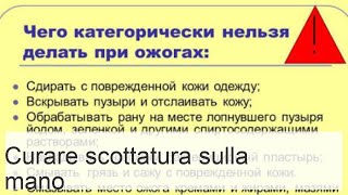 Scottura alla mano tipologie e gradi primo soccorso rimedi per le ustioni trattamento a casa [upl. by Niwroc721]