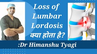 Loss of Lumbar lordosis क्या होता है [upl. by Oicanata]