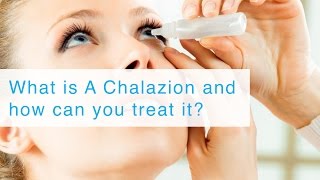 What is A Chalazion and how can you treat it [upl. by Gettings]