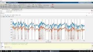 Pupillometry tutorial from A to Z 07 pupil data onsets filters range speed deviation [upl. by Darnell869]