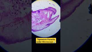 Tapeworm parasite under microscope tapeworm physicswallah biology unacademy adre [upl. by Fechter]