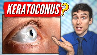 What is Keratoconus Keratoconus Eye Disease Explained [upl. by Chelsea]