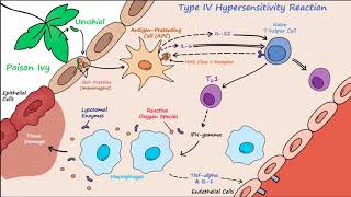 Type IV Hypersensitivity Described Concisely [upl. by Ytirehc]