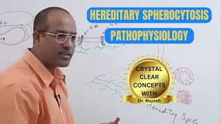 Hereditary Spherocytosis  Anemia  RBCs  Pathophysiology 🩺 [upl. by Azilanna]