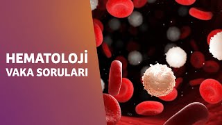 HEMATOLOJİ VAKA SORULARI  NİSAN 2021 [upl. by Eilhsa]