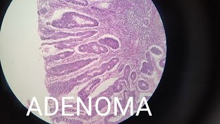 FULL HISTOLOGY SLIDES  PATHOLOGY MEDICAL  BDS SECOND YEAR [upl. by Annairol]