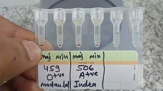 medicallabtechnologist6489 Blood Crossmatch Gel card method AgAbReaction MLT lab Blood [upl. by Jariah]