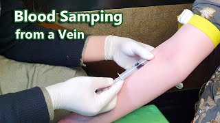 How to Take Venous Blood Sample  Venipuncture  Phlebotomy  Vein [upl. by Kuehn]