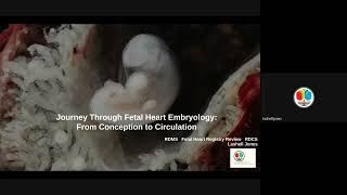 Lesson 10 Journey Through Fetal Heart Embryology From Conception to Circulation [upl. by Geraint529]