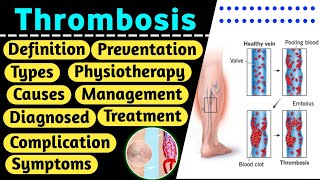 Thrombosis  Thrombosis in hindi  DVT  Thrombosis definition  thrombosis pathology [upl. by Nairrod]