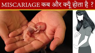 Miscarriage कैसे होता है I miscarriage symptoms I pregnancy miscarriage क्यूँ होता है I [upl. by Kihtrak]