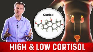 Difference Between Low Cortisol amp High Cortisol Symptoms – Dr Berg [upl. by Addie]