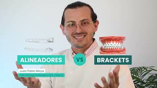 ¿Alineadores Invisibles vs Brackets Descubre las diferencias y cuál es mejor 😁⌚ [upl. by Sorkin]