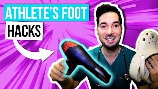 How to get rid of athletes foot between toes removal and treatment [upl. by Assille]