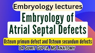 Atrial Septal Defects  Embryological basis [upl. by Annette974]