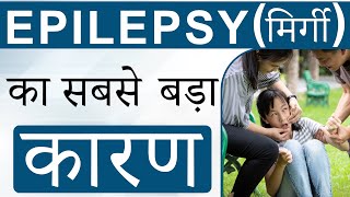 Epilepsy मिर्गी का सबसे बड़ा कारण  Epilepsy Causes amp Treatment [upl. by Pich]