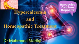 Hypercalcemia in Homeopathy [upl. by Richia]