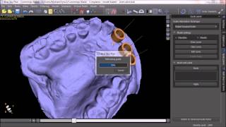 InHouse Digital Surgical Guide Fabrication with Blue Sky Plan [upl. by Peednam]