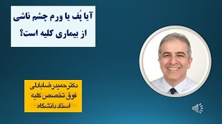 آیا همیشه ورم یا پُف چشم بدلیل نارسایی کلیه ها است؟ [upl. by Aicel]