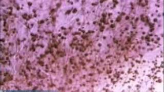 Penicillium Mold Growth [upl. by Jarad656]