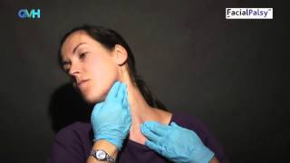 Facial Palsy DVD 2  Management of Synkinesis  Stretches for the Tight Side [upl. by Negroj307]