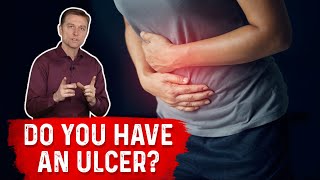 Understanding Ulcers How Do You Know If You Have One – Dr Berg [upl. by Amles959]