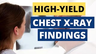 How To Read An XRay When Your Attending Asks  Pt 2 High Yield Findings [upl. by Anilac462]