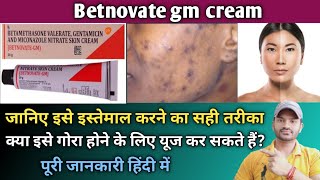 Betnovate gm cream use dose benefits and side effects full review in hindi [upl. by Baptista]