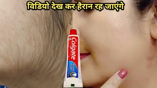 Stop face wax👉होठों के ऊपर के बाल hard upper lip hair सिर्फ दो बूंद में गायब😱 Facial Hair Removal [upl. by Amalburga]