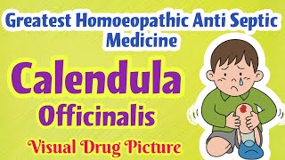 Calendula Officinalis Homoeopathic Mother Tincture UsesSymptoms  Antiseptic for Cuts Wound [upl. by Zabrine784]