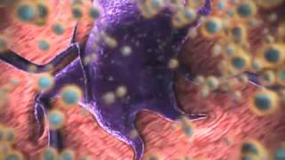 nanomedicine nanotechnology for cancer treatment [upl. by Ayota]