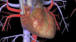 Heart Bypass Surgery CABG [upl. by Othello]