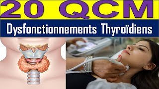 20 QCM Hyperthyroïdie ou Hypothyroïdie  Découvrez les Causes et Solutions [upl. by Aitnwahs]