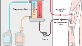 Lebensretter Dialyse  Nierenersatztherapie [upl. by Eenaj]