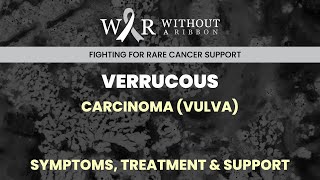 VERRUCOUS CARCINOMA VULVA – SYMPTOMS TREATMENT amp SUPPORT [upl. by Suzetta867]