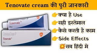 tenovate cream uses  price  composition  dose  side effects  review  in hindi [upl. by Eeleak]