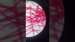 Striated Muscle tissue Slide Under Microscope Class 9 Science  Tissue [upl. by Juieta]