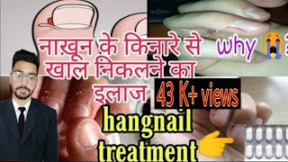 ❌Peeling Cuticles Problem And Home remedyनाख़ून के किनारे से खाल निकलनाNail केपास की Skin छिल जाती [upl. by Trefler392]