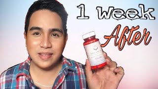 RELUMINS GLUTA1000 REVIEW AFTER 1 WEEK  Edrian Sasutil [upl. by Ecad147]