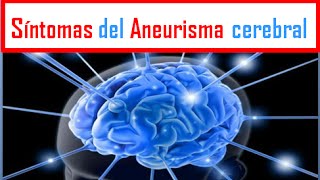 ANEURISMA Síntomas del Aneurisma cerebral [upl. by Noiram]