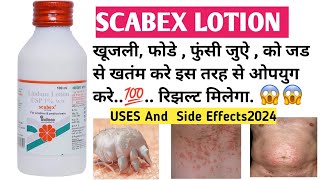 SCABEX LOTION  USE IN HINDI 2024  NEW scabies scabex bacteria infection medicine allergy [upl. by Ramo]