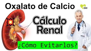 Prevención del Cólico Renal por Oxalato de Calcio Recomendaciones Médicas [upl. by Nikoletta]