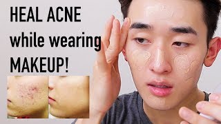 BEST CUSHION Foundations for ACNEPRONE SKIN  Ivan Lam [upl. by Enilrek]