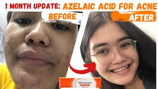 SKINOREN CREAM REVIEW  AZELAIC ACID [upl. by Aurita292]